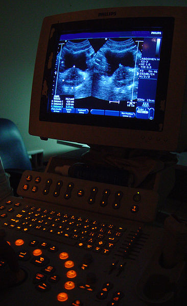 Video of Ultrasounds can can be stored-and-fowarded to a specialist.